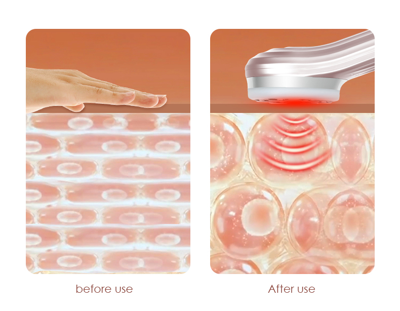 FACIAL BEAUTY INSTRUMENT TAGS: HOME RF BEAUTY DEVICE, HOME RF BEAUTY EQUIPMENT, HOME RF BEAUTY MACHINE, RF BEAUTY DEVICE, RF BEAUTY EQUIPMENT, RF BEAUTY MACHINE